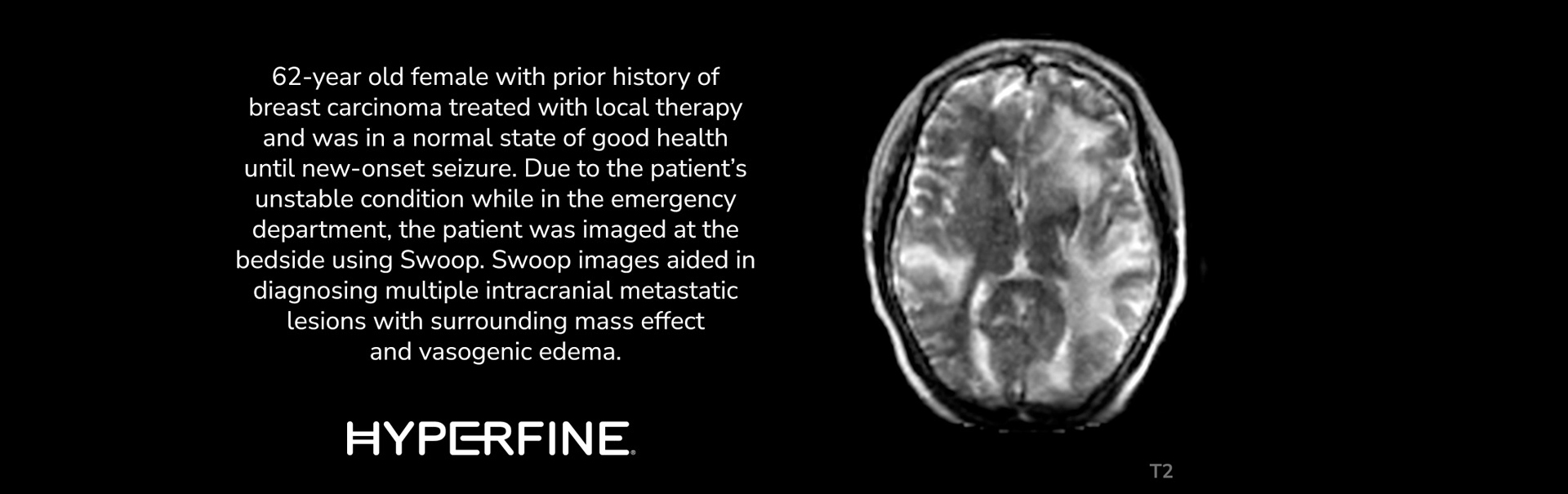 Mass Lesion Clinical Images